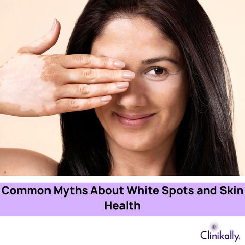 Common Myths About White Spots and Skin Health
