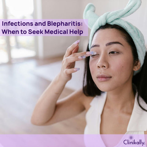 Infections and Blepharitis: When to Seek Medical Help
