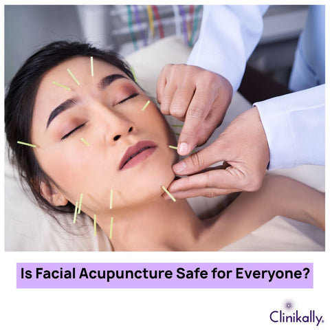 Is Facial Acupuncture Safe for Everyone?