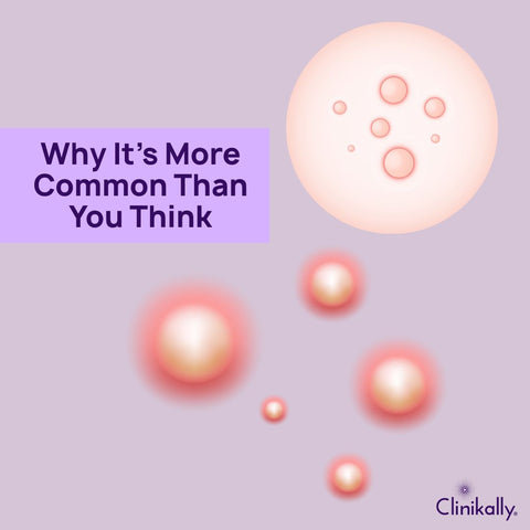 Why It’s More Common Than You Think