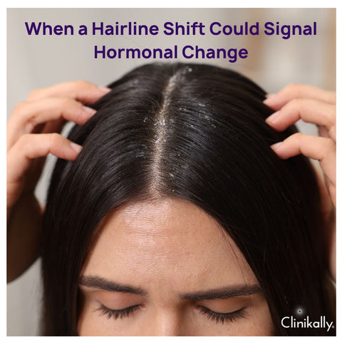 When a Hairline Shift Could Signal Hormonal Change