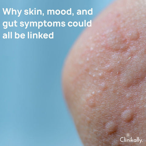 Why skin, mood, and gut symptoms could all be linked