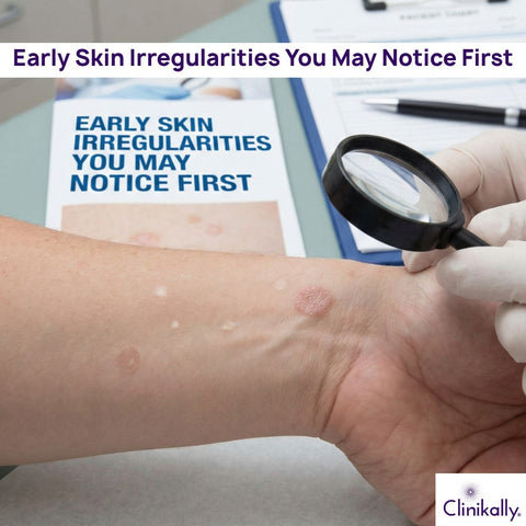 Early Skin Irregularities You May Notice First