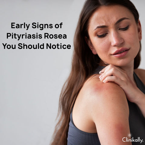 Signs of Pityriasis Rosea