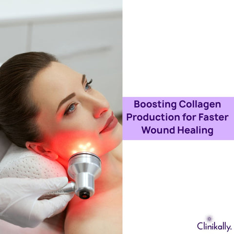 Boosting Collagen Production