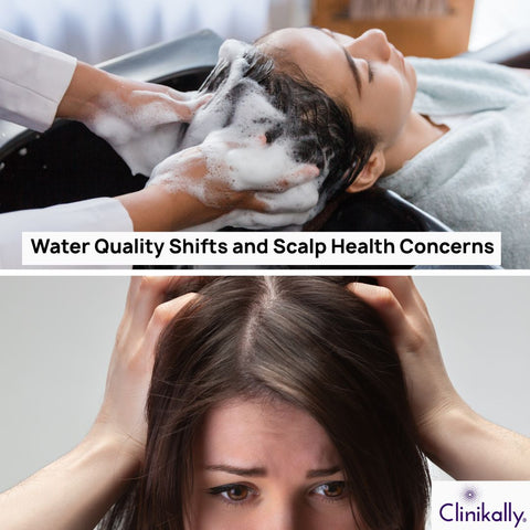 Water Quality Shifts and Scalp Health Concerns