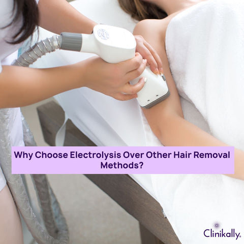 Why Choose Electrolysis Over Other Hair Removal Methods?