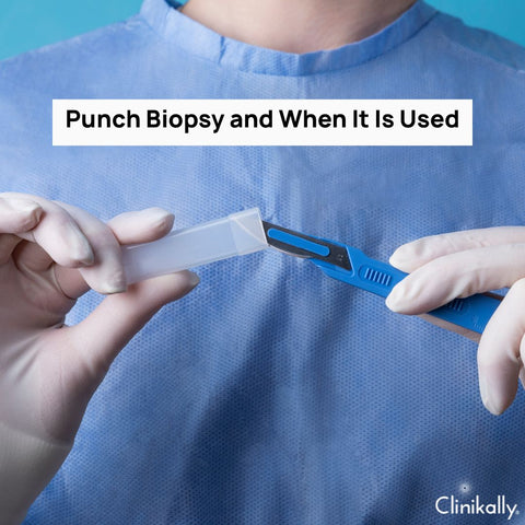 Punch Biopsy and When It Is Used