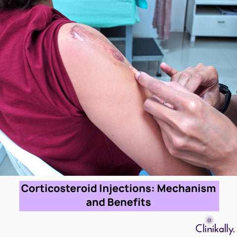 Benefits of Corticosteroid Injections