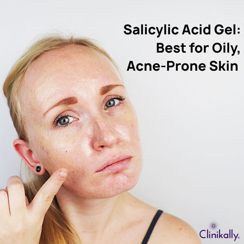 Salicylic Acid Gel: Best for Oily, Acne-Prone Skin