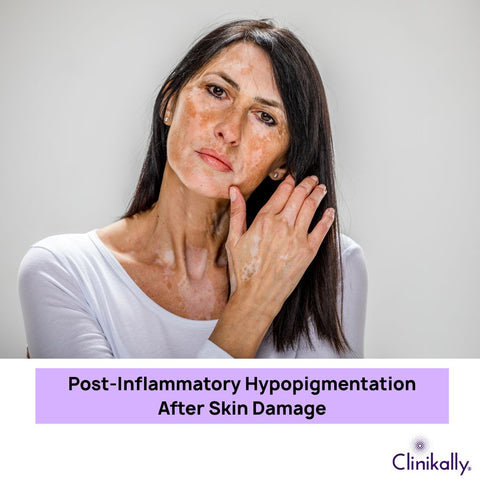 Post-Inflammatory Hypopigmentation After Skin Damage
