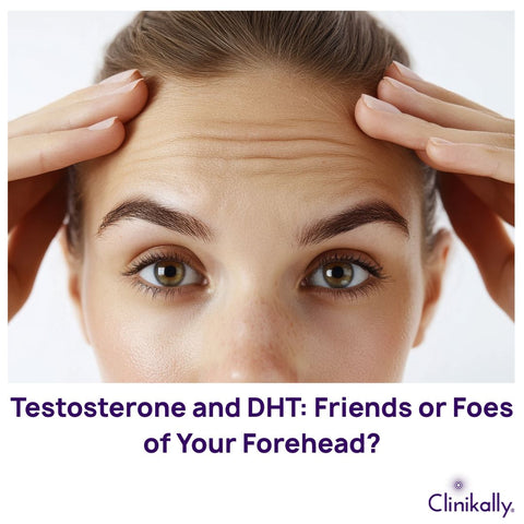 Testosterone and DHT: Friends or Foes of Your Forehead?