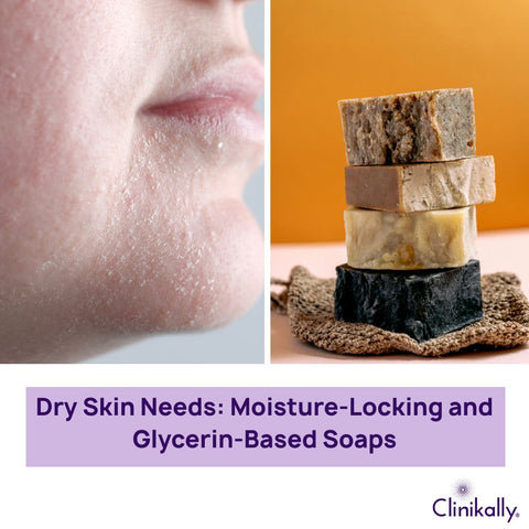 Dry Skin Needs: Moisture-Locking and Glycerin-Based Soaps