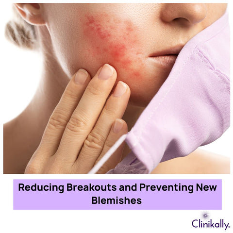 Reducing Breakouts and Preventing New Blemishes