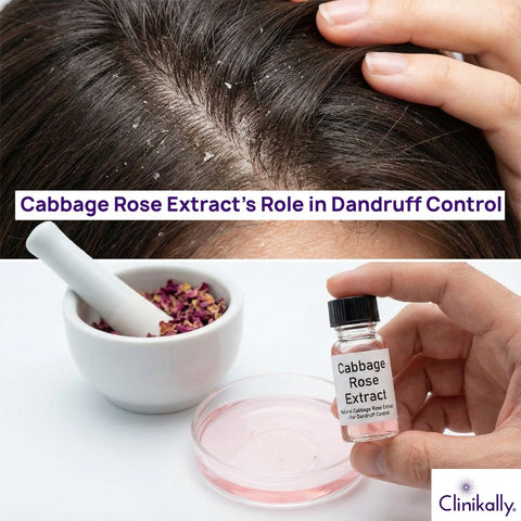 Cabbage Rose Extract’s Role in Dandruff Control