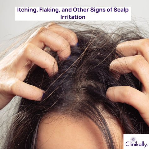 Itching, Flaking, and Other Signs of Scalp Irritation