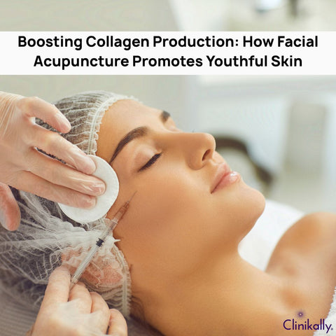 Boosting Collagen Production: How Facial Acupuncture Promotes Youthful Skin