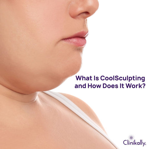 What Is CoolSculpting and How Does It Work?