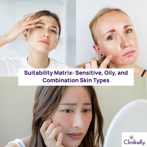 Suitability Matrix: Sensitive, Oily, and Combination Skin Types
