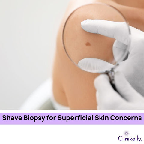 Shave Biopsy for Superficial Skin Concerns