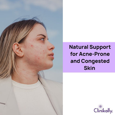 Natural Support for Acne-Prone and Congested Skin