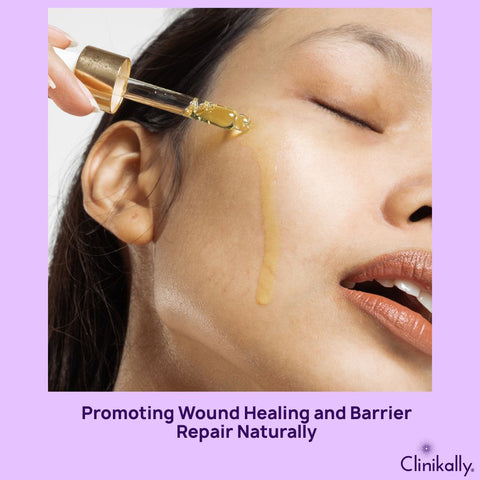 Promoting Wound Healing and Barrier Repair Naturally