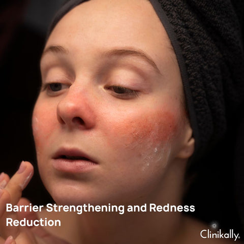 Barrier Strengthening and Redness Reduction