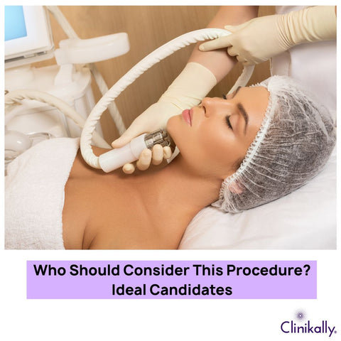Ideal Candidates for Nefertiti Lift procedure