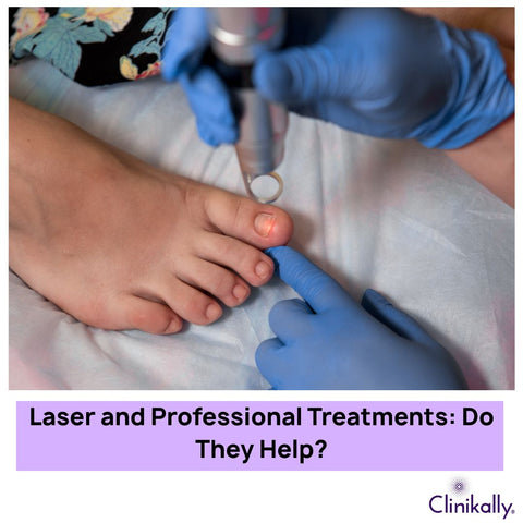 Laser and Professional Treatments: Do They Help?