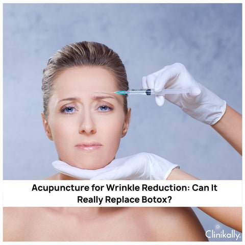 Acupuncture for Wrinkle Reduction: Can It Really Replace Botox?