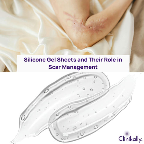 Silicone Gel Sheets and Their Role in Scar Management