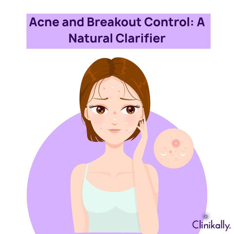 Acne and Breakout Control: A Natural Clarifier
