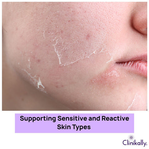 Supporting Sensitive and Reactive Skin Types