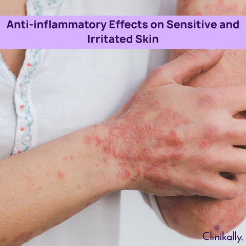 Anti-inflammatory Effects on Sensitive and Irritated Skin