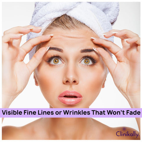 Visible Fine Lines or Wrinkles That Won’t Fade