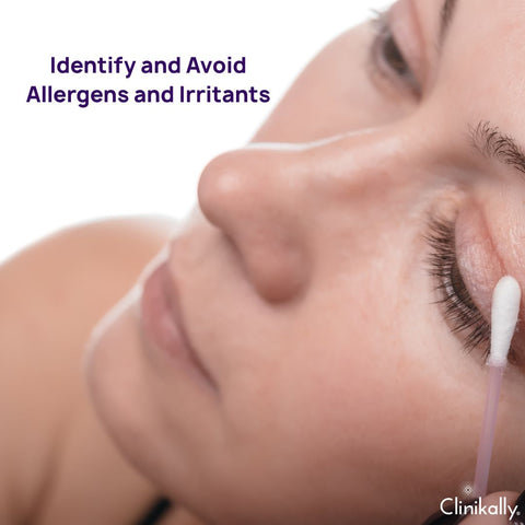 Identify and Avoid Allergens and Irritants