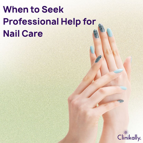 When to Seek Professional Help for Nail Care