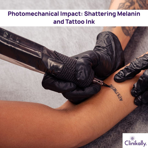 Photomechanical Impact: Shattering Melanin and Tattoo Ink