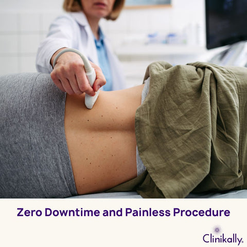 Zero Downtime and Painless Procedure
