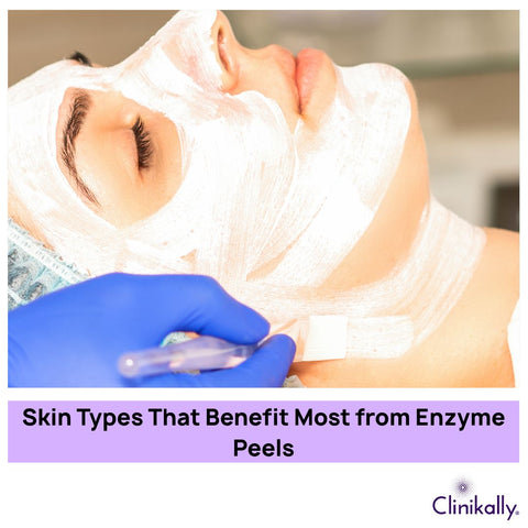 Skin Types That Benefit Most from Enzyme Peels
