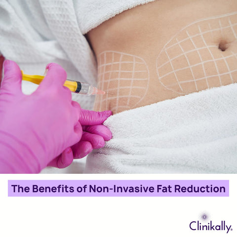 The Benefits of Non-Invasive Fat Reduction