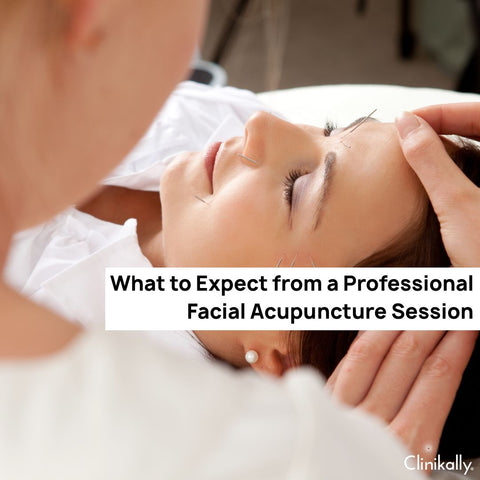 What to Expect from a Professional Facial Acupuncture Session