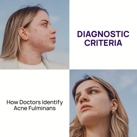 Diagnostic Criteria: How Doctors Identify Acne Fulminans