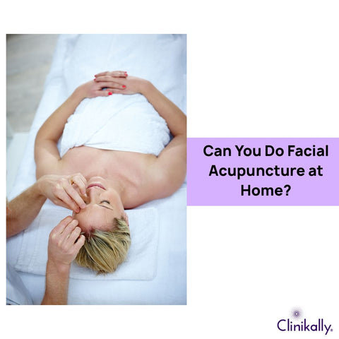 Can You Do Facial Acupuncture at Home?