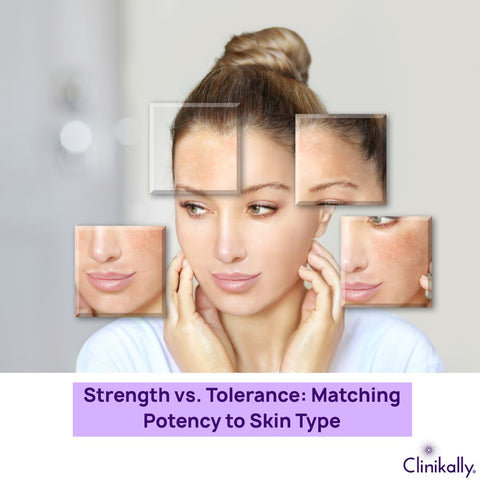 Strength vs. Tolerance: Matching Potency to Skin Type
