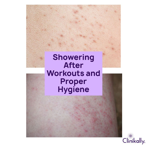 Showering After Workouts and Proper Hygiene