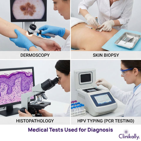 Medical Tests for EV