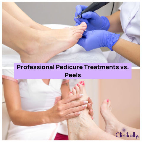 Professional Pedicure Treatments vs. Peels
