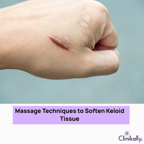 Massage Techniques to Soften Keloid Tissue