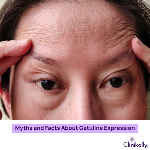 Myths and Facts About Gatuline Expression